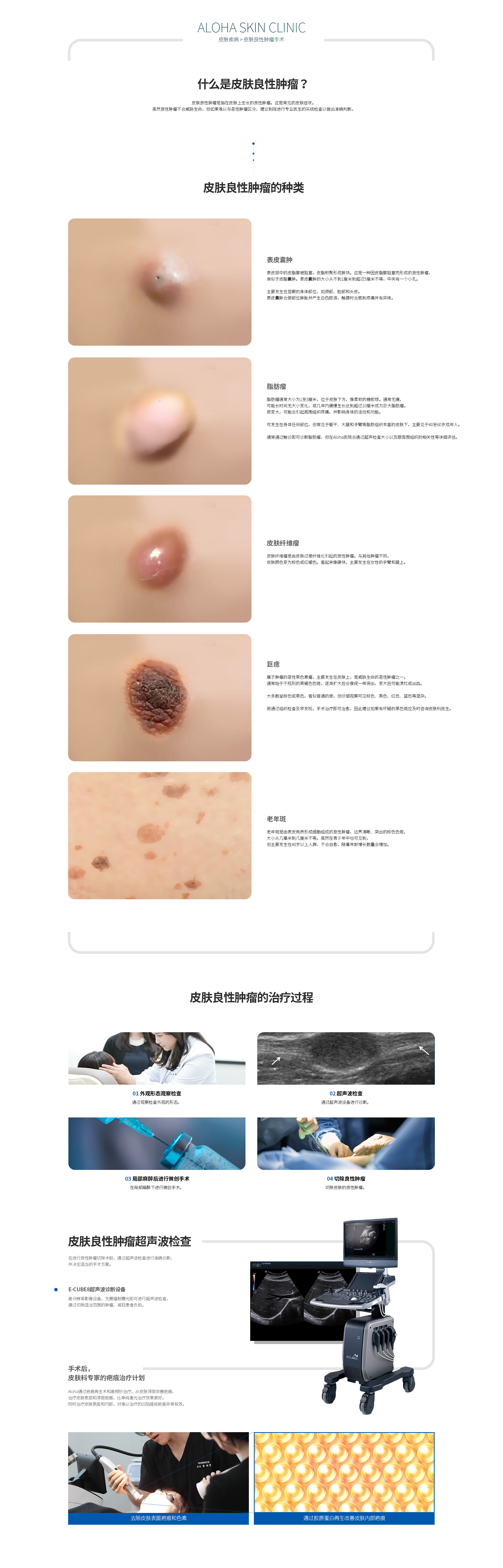 皮肤良性肿瘤手术